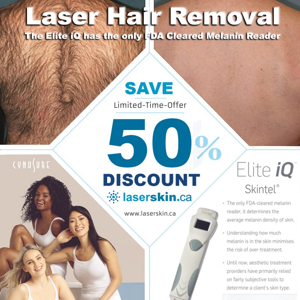 best laser hair removal Toronto for permanent hair removal