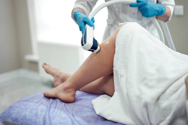 Best Laser Hair Removal Toronto