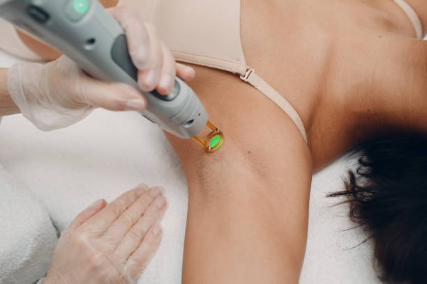 laser hair removal cost - full body laser hair removal cost