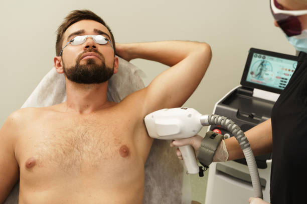 Laser Hair Removal For Men